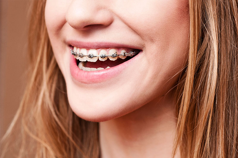 Studio City Orthodontics